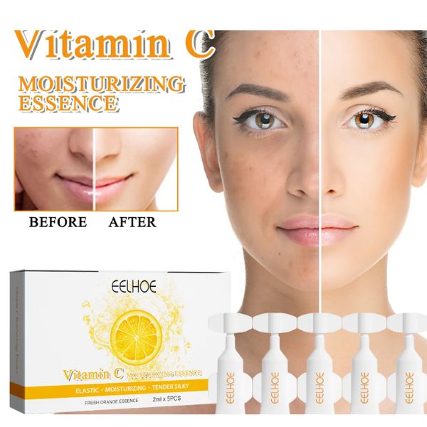 xr:d:DAFffiCAmKo:3,j:2350170465,t:23040807