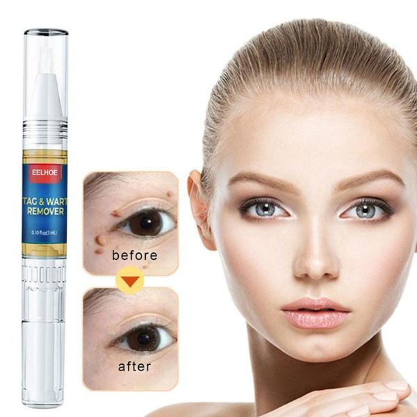 xr:d:DAFff1Hf98c:2,j:44814889021,t:23040807