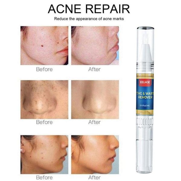 xr:d:DAFff1Hf98c:2,j:44814889021,t:23040807