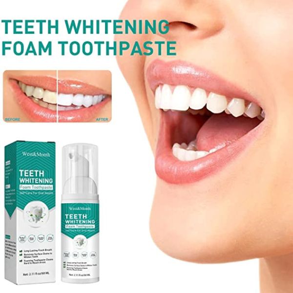 xr:d:DAFe5QtbYWs:2,j:44441508805,t:23040121